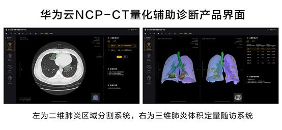 bu：科技战疫：AI是如何驰援抗疫一线的？-区块链315